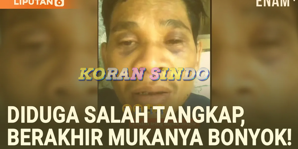 Salah Tangkap, Pria di Cianjur Bonyok dan Ngadu ke Dedi Mulyadi!